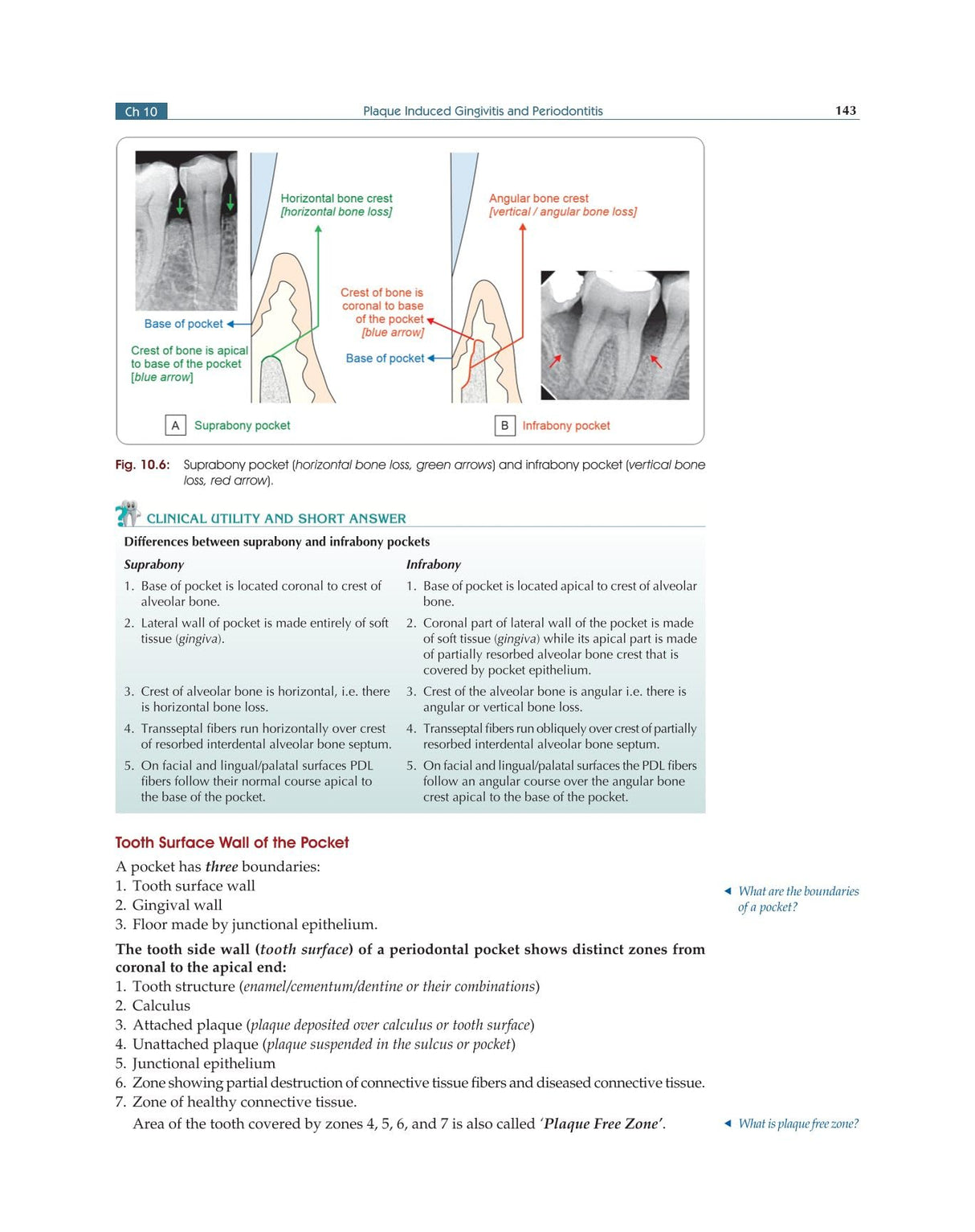 Textbook of Periodontology for Undergraduate Students - 2024 - Retail Maharaj
