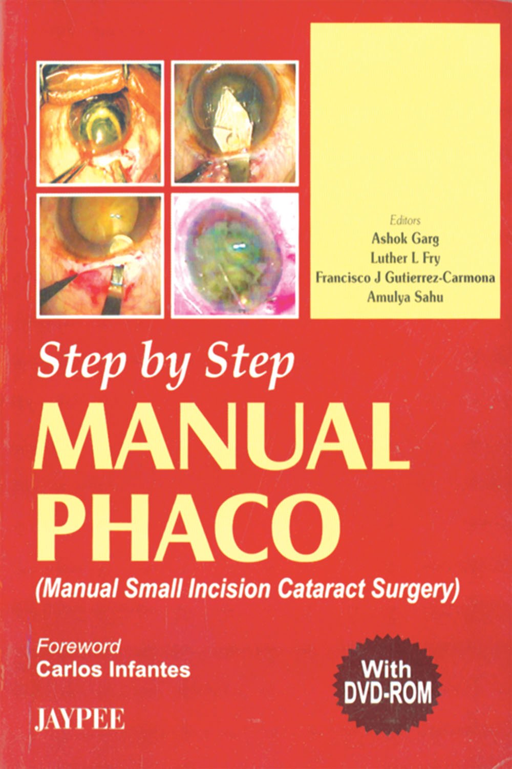 Step By Step Manual Phaco With Dvd-Rom - Retail Maharaj
