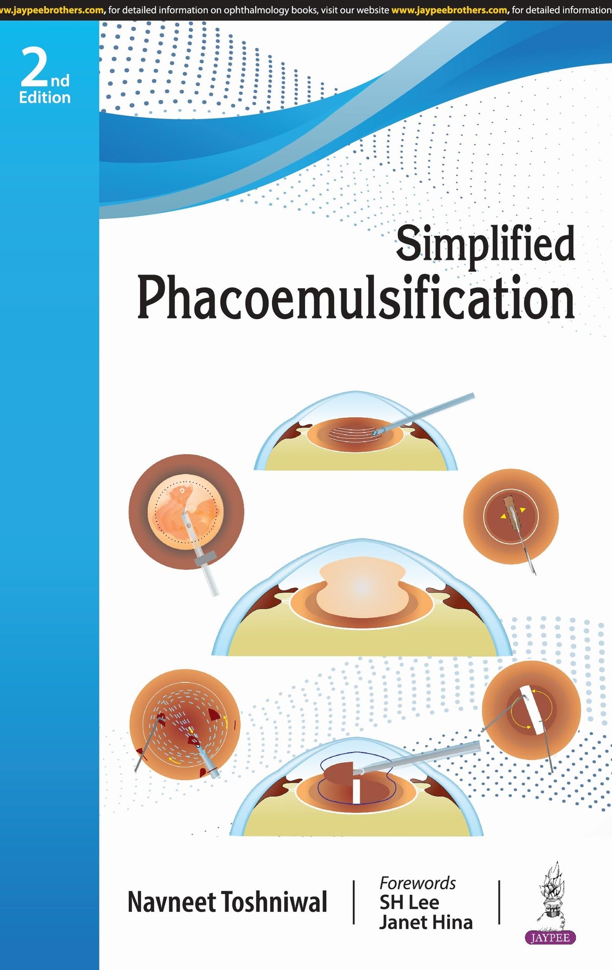 SIMPLIFIED PHACOEMULSIFICATION - Retail Maharaj
