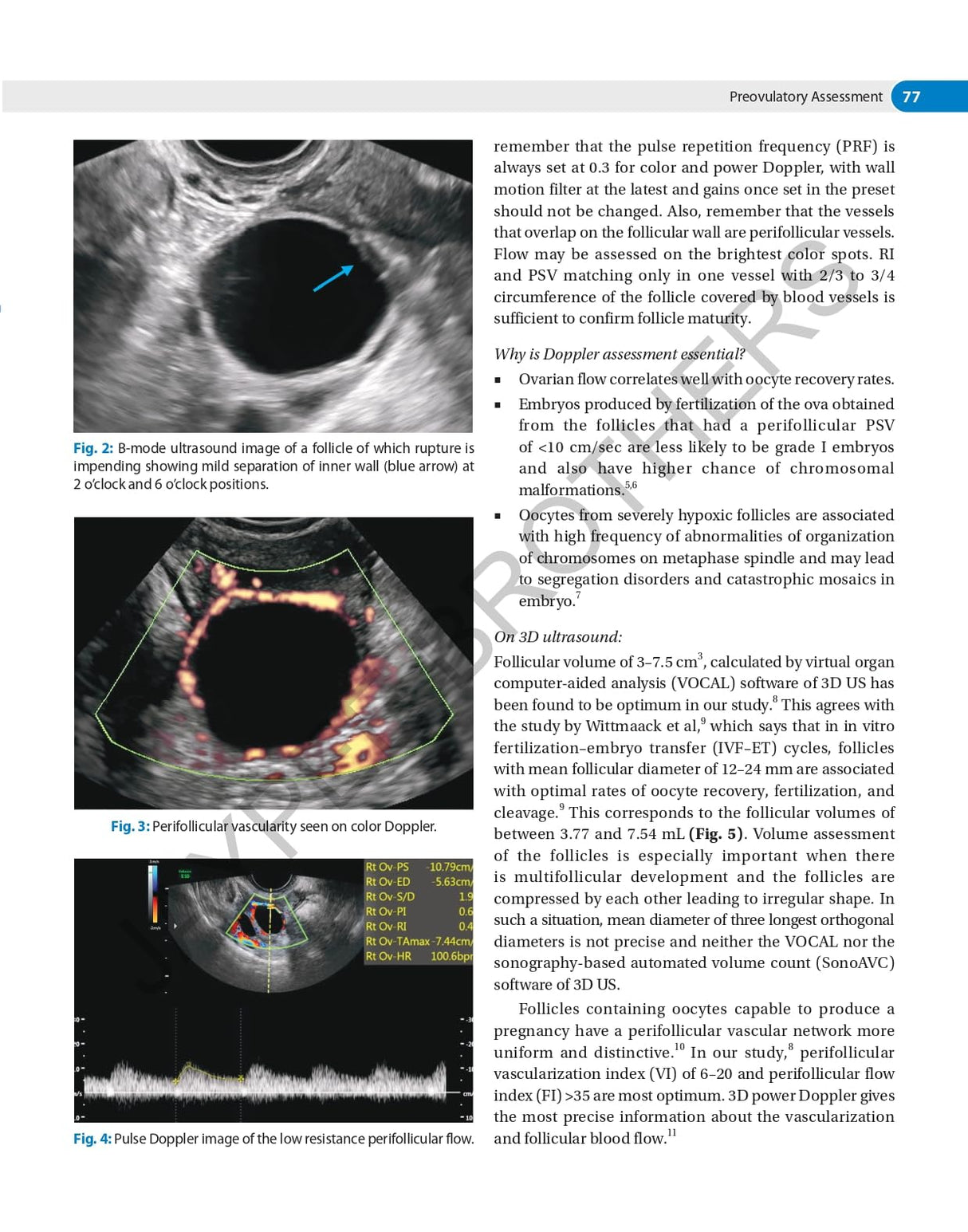 DECISION MAKING IN TRANSVAGINAL SONOGRAPHY - Retail Maharaj