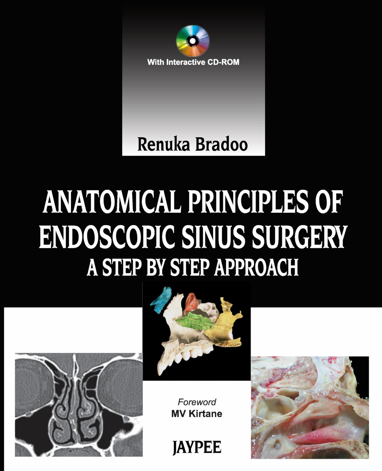 ANATOMICAL PRINCIPLES OF ENDOSCOPIC SINUS SURGERY: A STEP BY STEP APPROACH WITH INTERACTIVE CD-ROM - Retail Maharaj