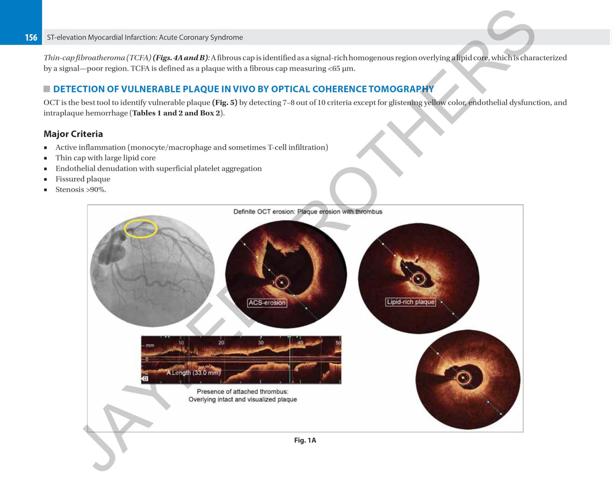 CORONARY OCT A CASE-BASED APPROACH - Retail Maharaj