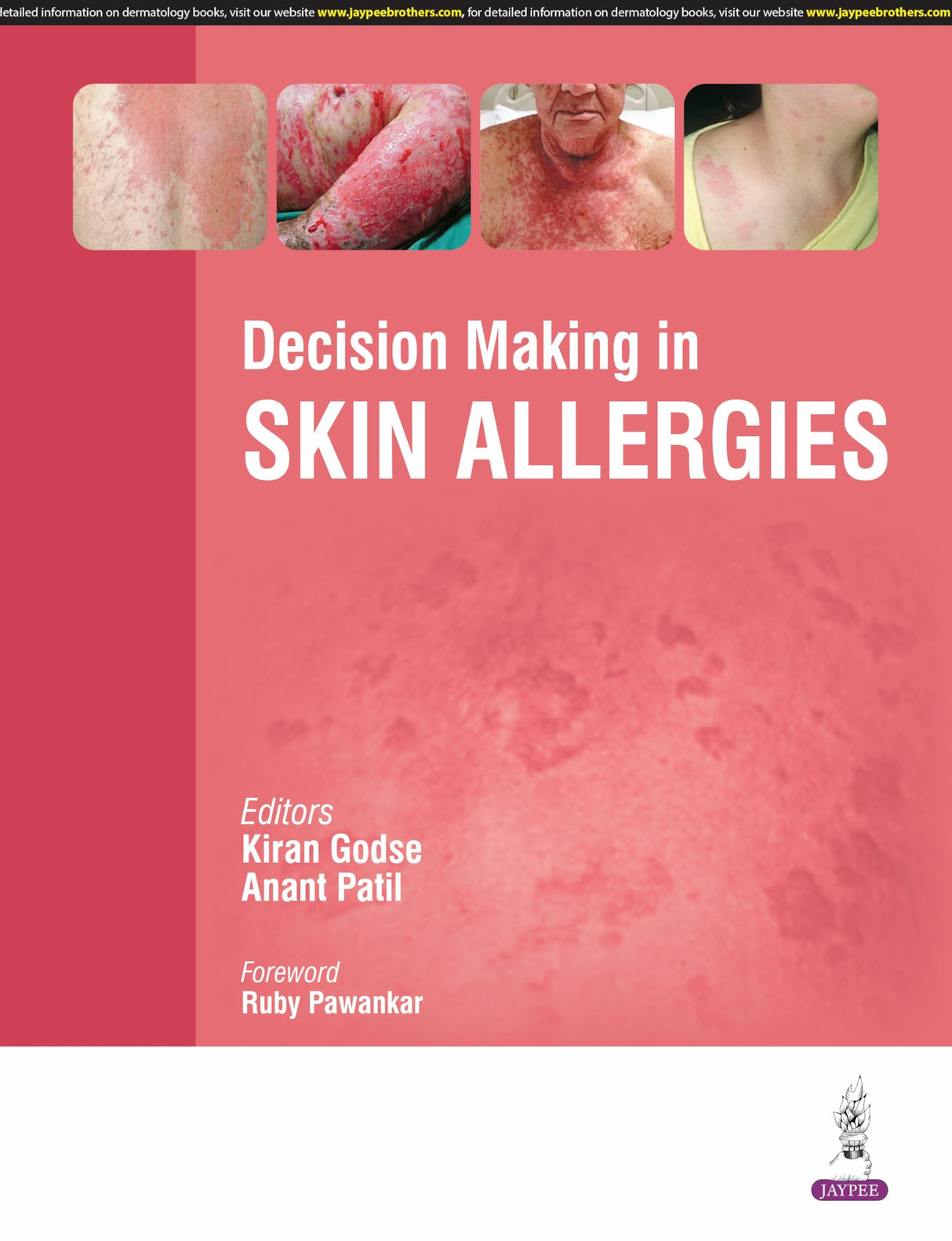 DECISION MAKING IN SKIN ALLERGIES - Retail Maharaj
