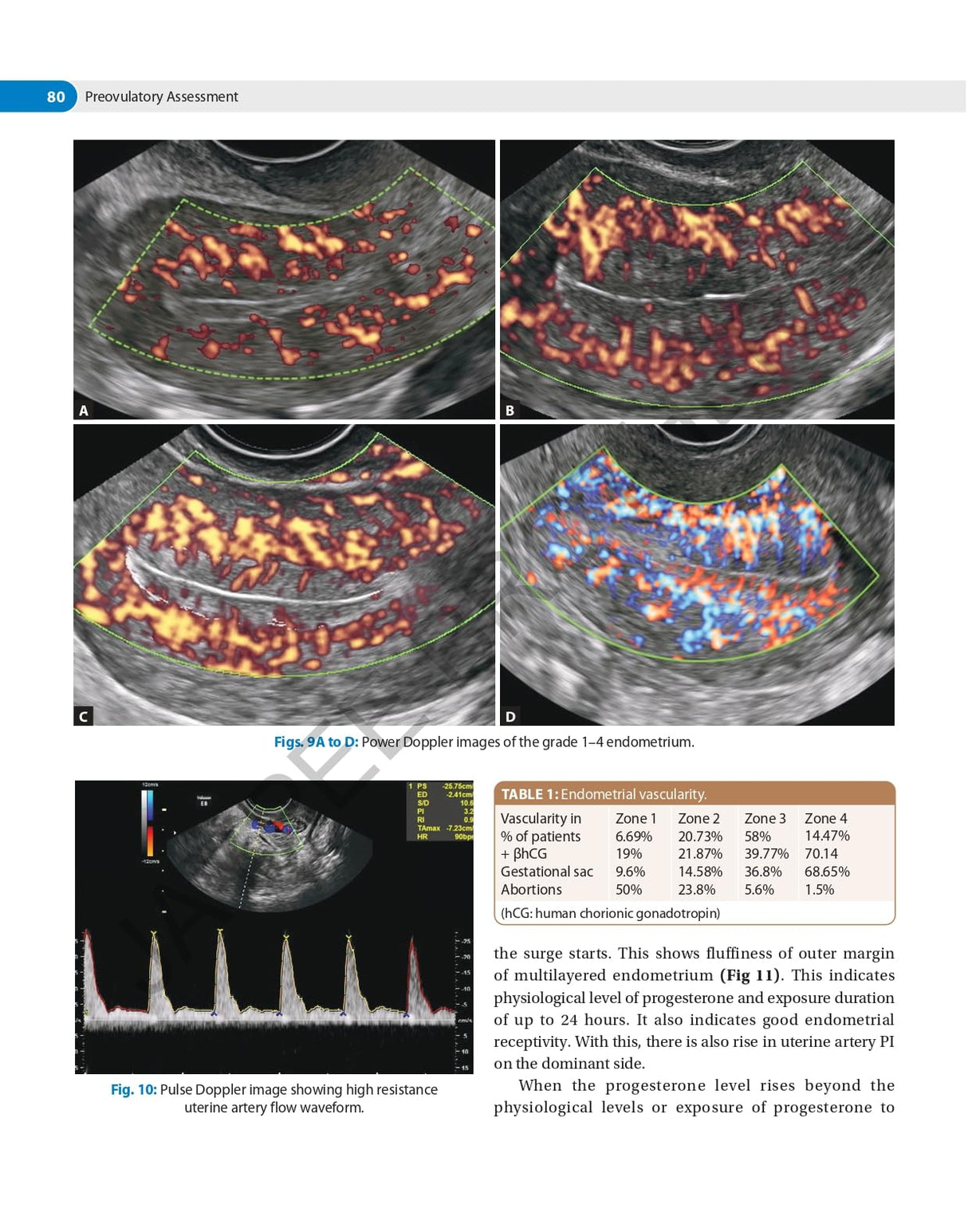 DECISION MAKING IN TRANSVAGINAL SONOGRAPHY - Retail Maharaj
