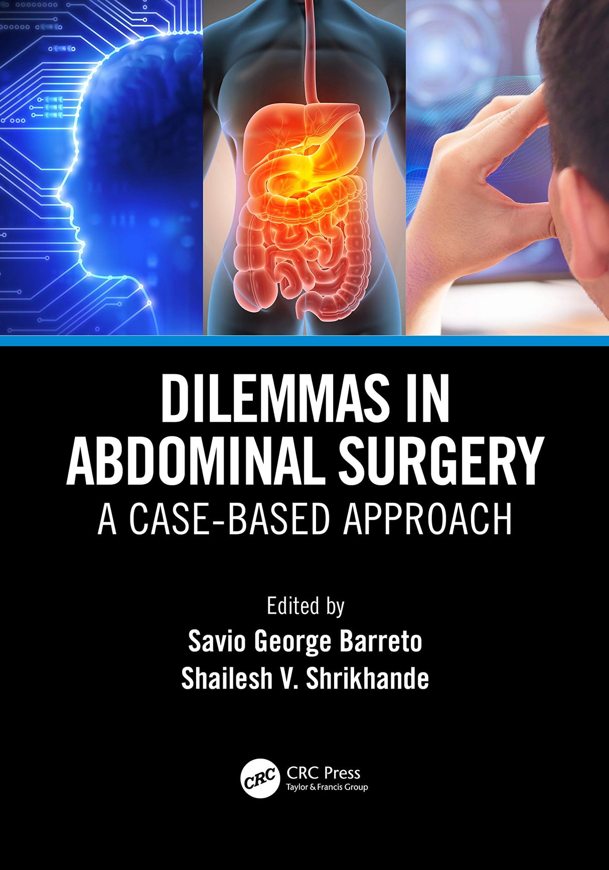 Dilemmas In Abdominal Surgery A Case Based Approach (Pb 2021) - Retail Maharaj