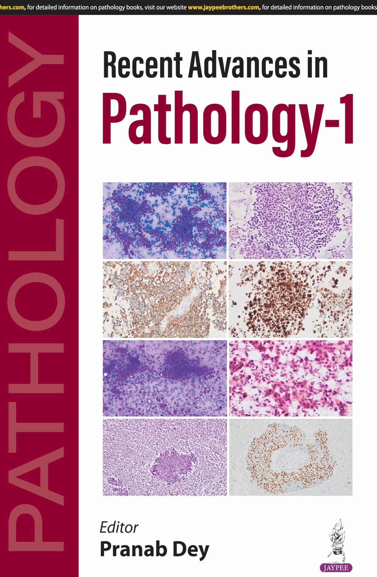 RECENT ADVANCES IN PATHOLOGY-1 - Retail Maharaj