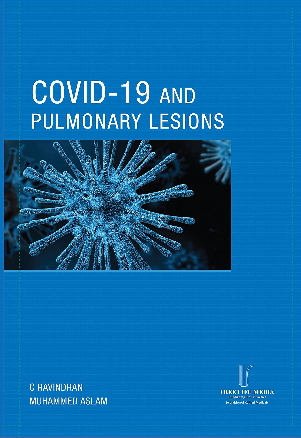 COVID - 19 AND PULMONARY LESIONS - Retail Maharaj