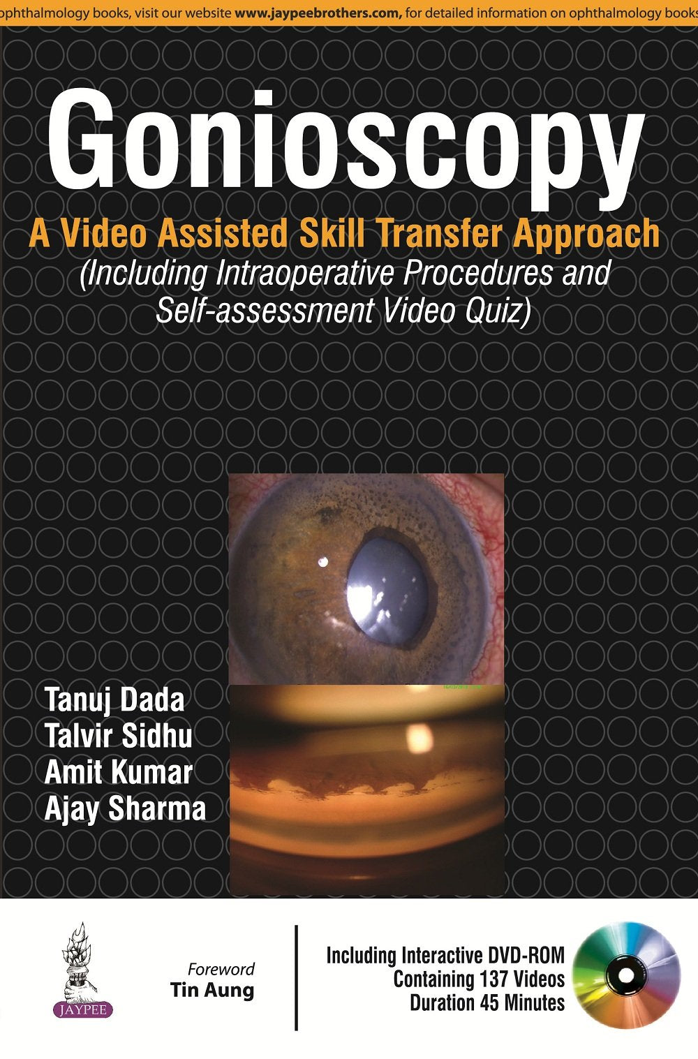 GONIOSCOPY:A VIDEO ASSISTED SKILL TRANSFER APPROACH WITH DVD-ROM - Retail Maharaj