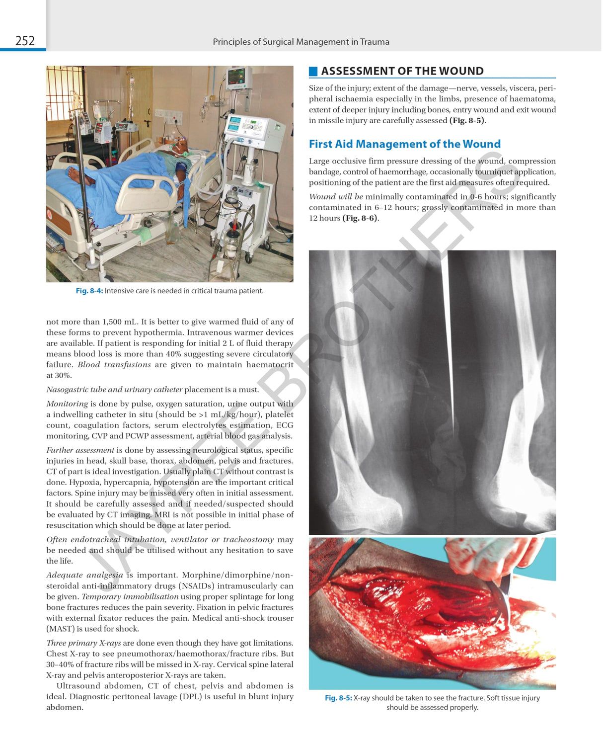 SRB'S SURGICAL OPERATION TEXT AND ATLAS (2 VOLS) - Retail Maharaj
