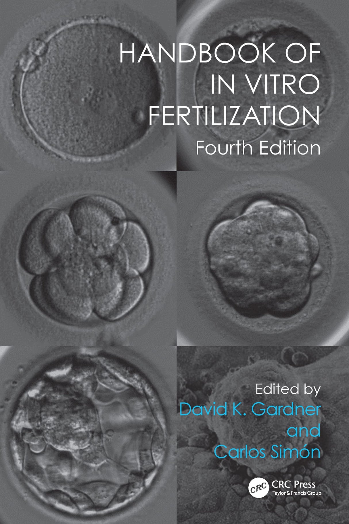 Handbook of In Vitro Fertilization - Retail Maharaj