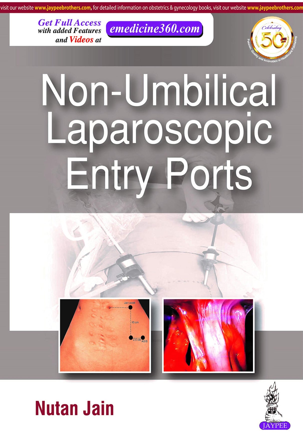 NON-UMBILICAL LAPAROSCOPIC ENTRY PORTS - Retail Maharaj