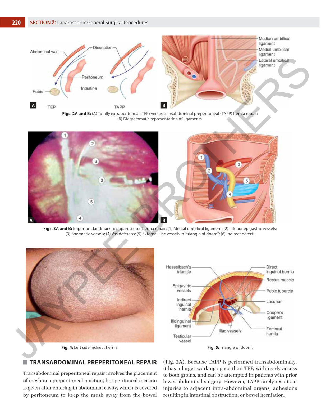 Textbook of Laparoscopy for Surgeons and Gynecologists - Retail Maharaj