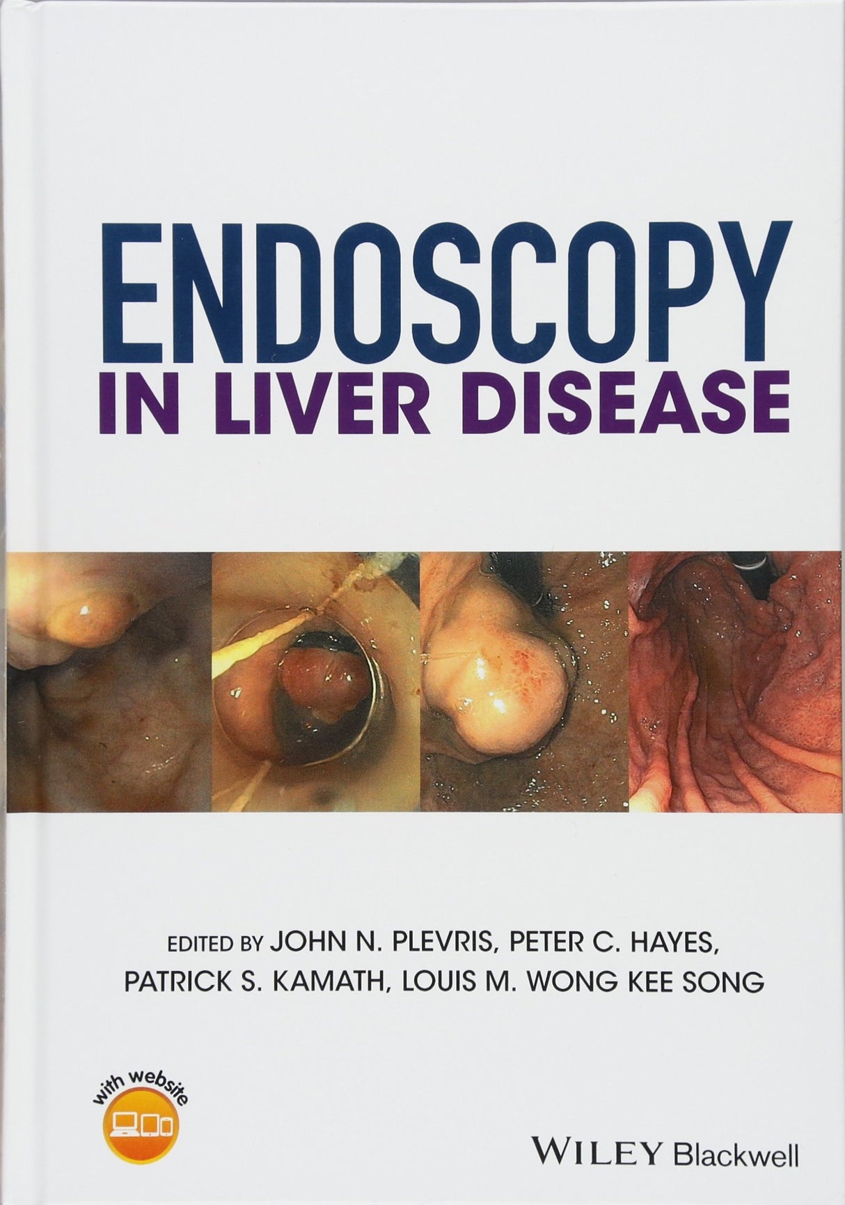 Endoscopy In Liver Disease (Hb 2018) - Retail Maharaj