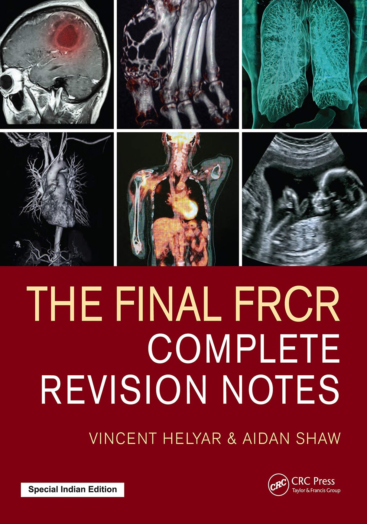 The Final FRCR Complete Revision Notes - Retail Maharaj
