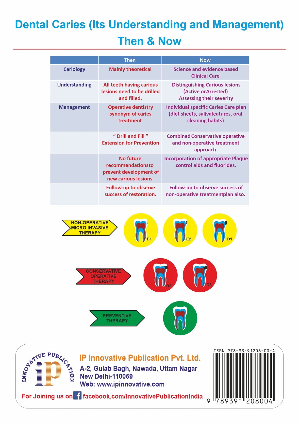 Dental Caries (Its Understanding and Management) Then & Now - Retail Maharaj