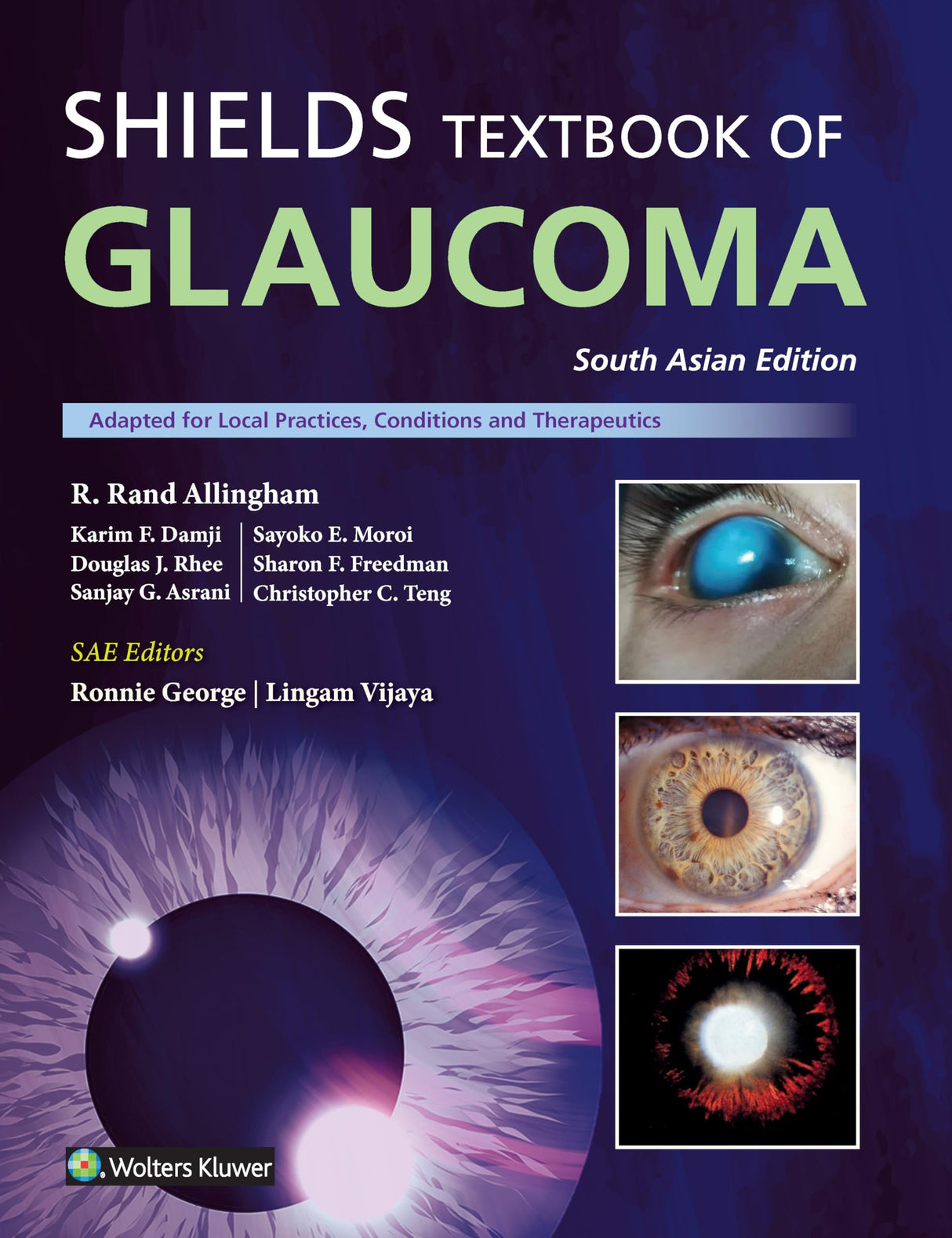 Shield’s Textbook of Glaucoma, South Asian ed - Retail Maharaj