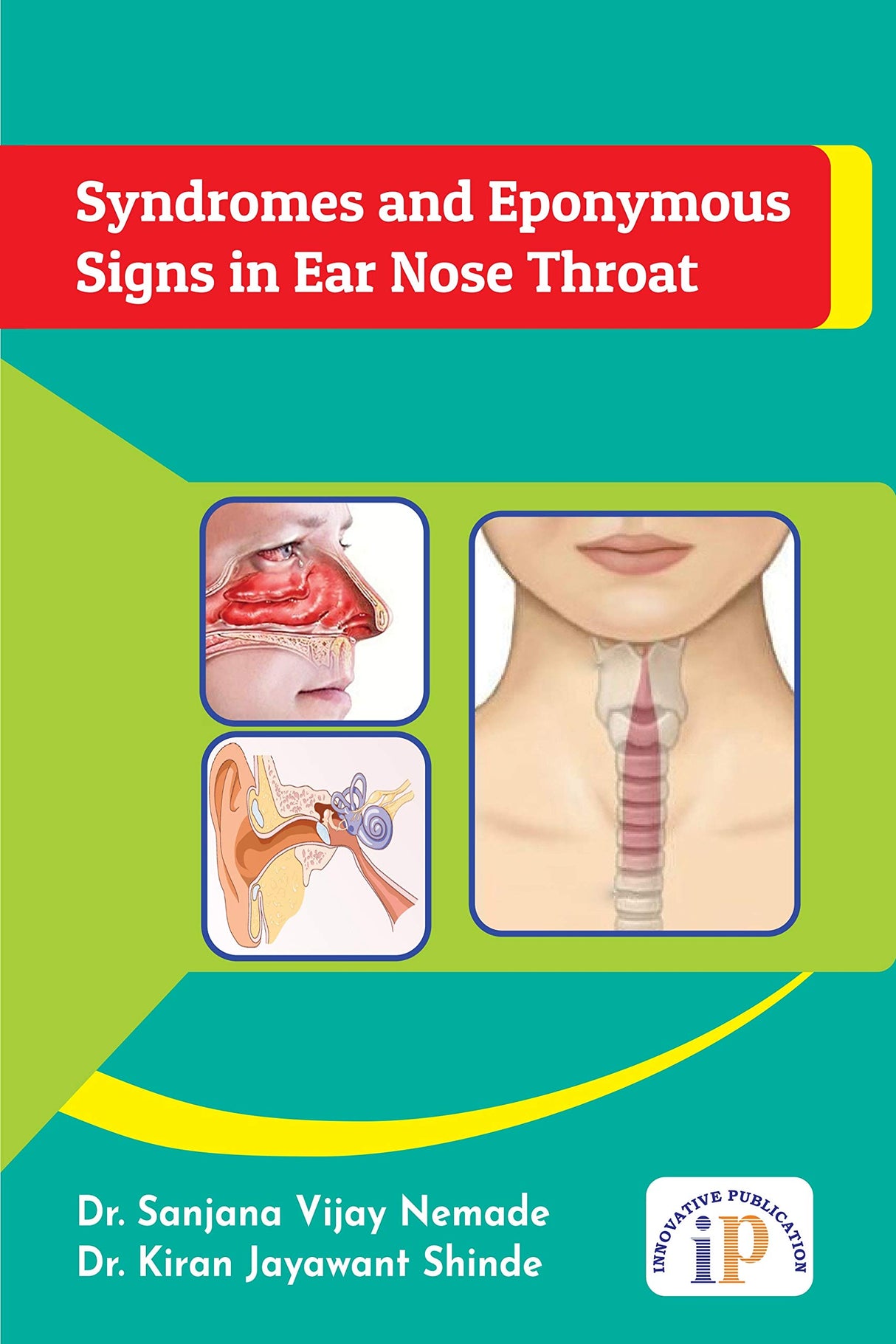 Syndromes and Eponymous Signs in Ear Nose Throat - Retail Maharaj
