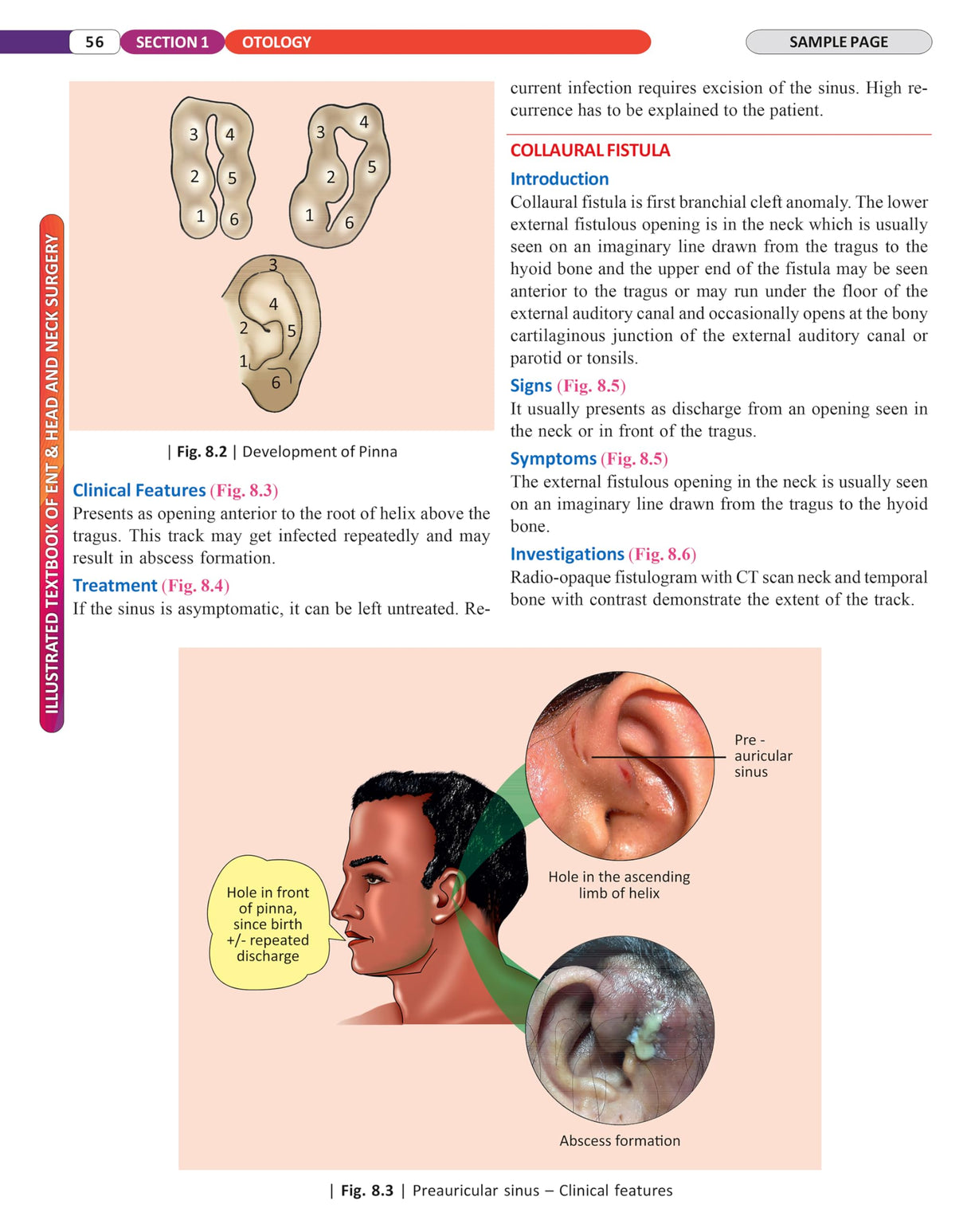 Illustrated Textbook of ENT and Head & Neck Surgery (1st Edition 2025) - Retail Maharaj