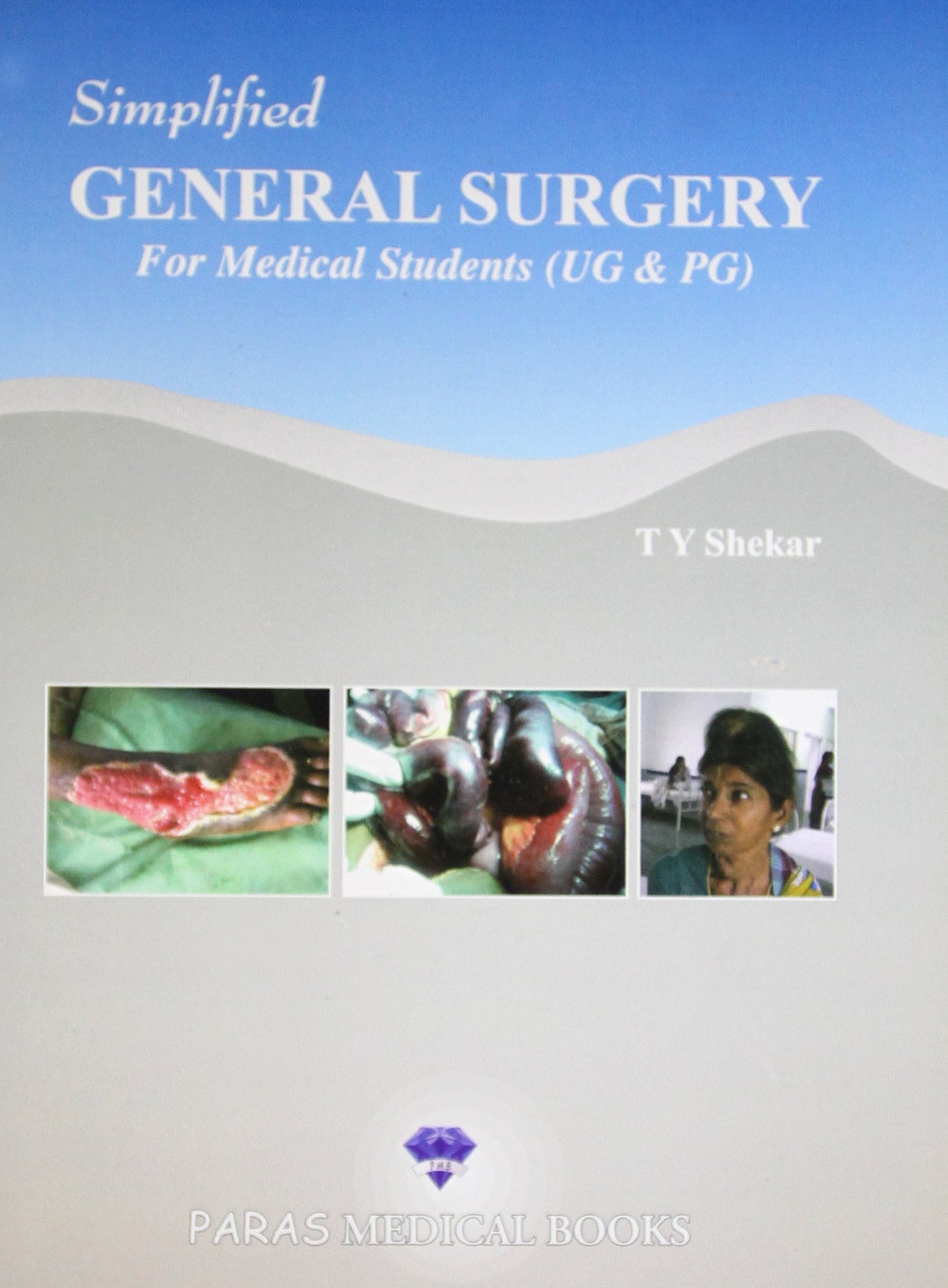 Simplified General Surgery for Medical Students(UG & PG) 1/E - Retail Maharaj