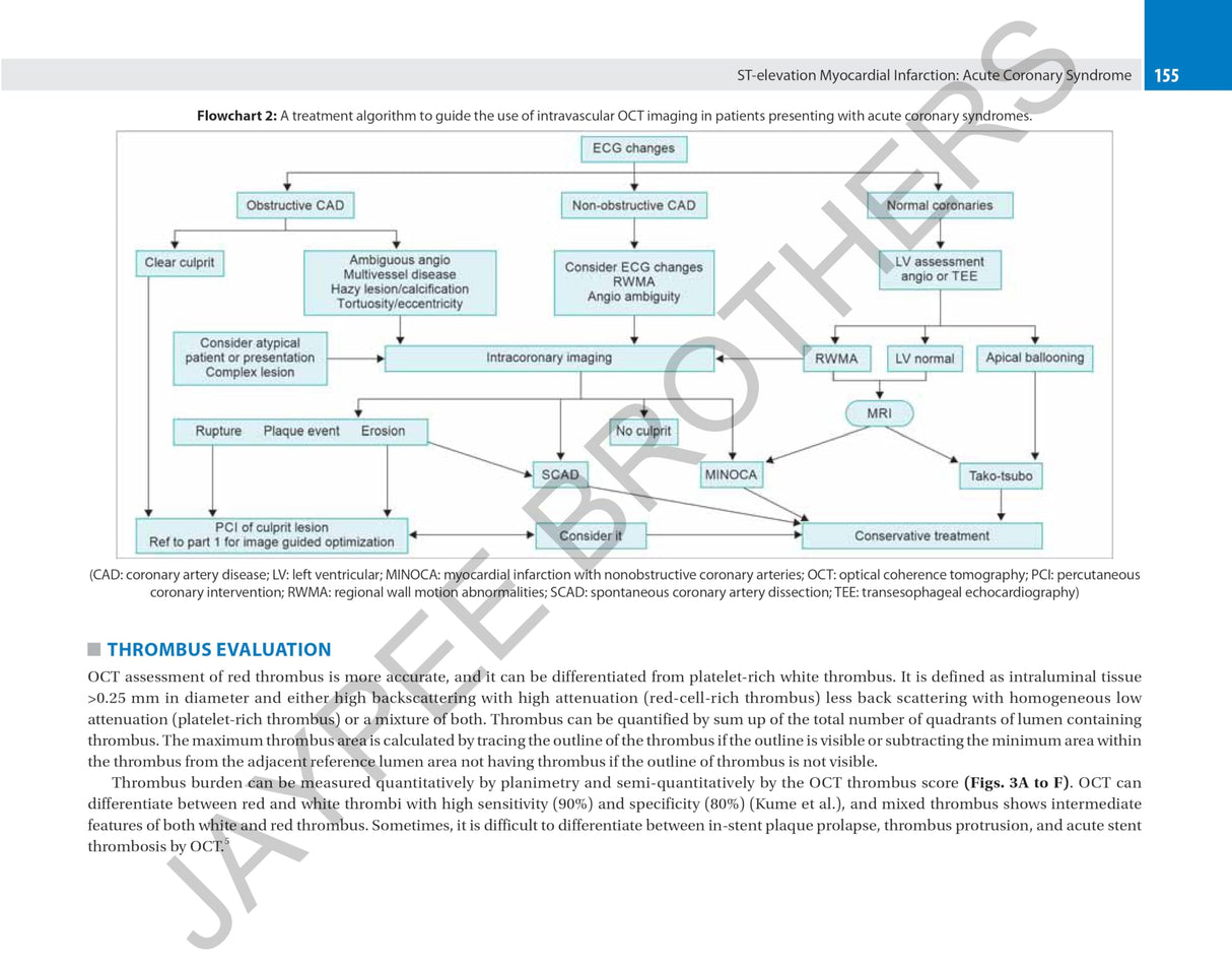CORONARY OCT A CASE-BASED APPROACH - Retail Maharaj