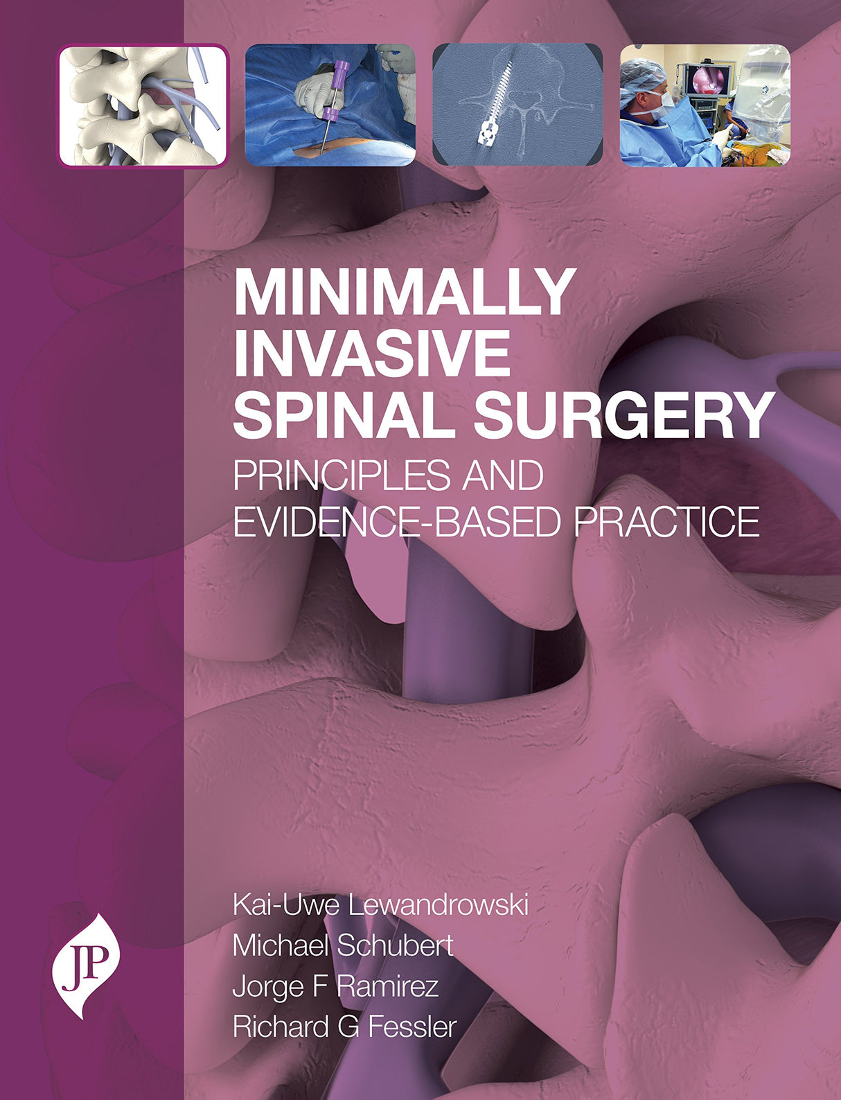 Minimally Invasive Spinal Surgery: Principles and Evidence-Based Practice - Retail Maharaj