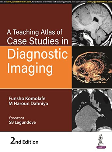 A Teaching Atlas of Case Studies in Diagnostic Imaging - Retail Maharaj
