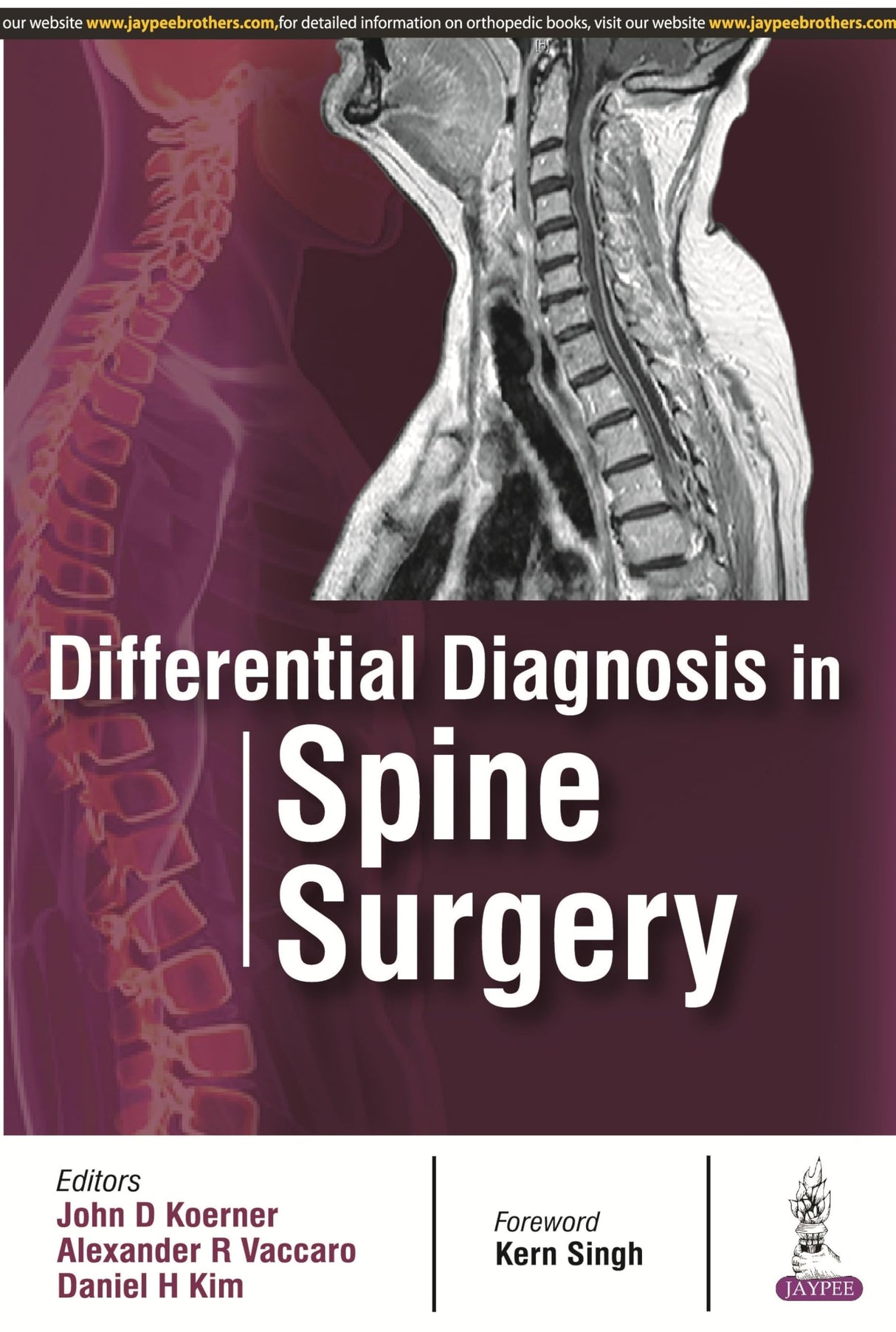 DIFFERENTIAL DIAGNOSIS IN SPINE SURGERY - Retail Maharaj