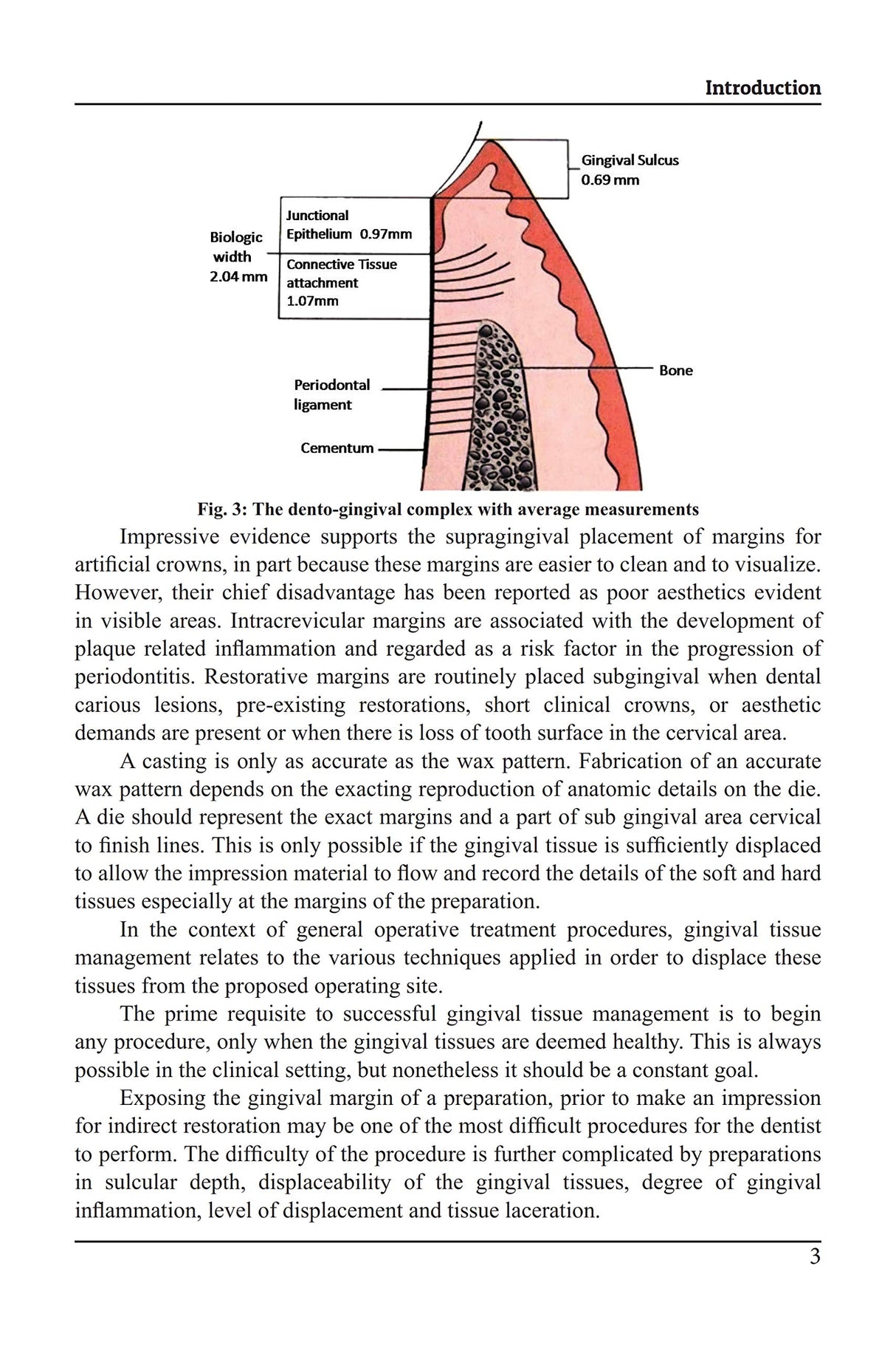 Gingival Tissue Management: Emphasis on Operative and Prosthodontic Aspect, Dec 2019, Operative Dentistry Books - Retail Maharaj