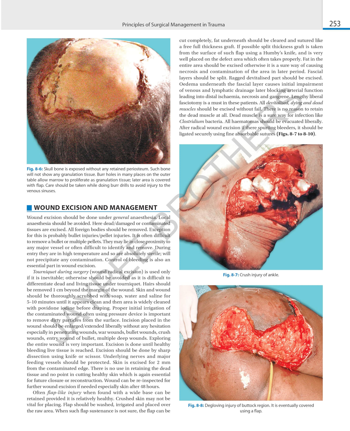 SRB'S SURGICAL OPERATION TEXT AND ATLAS (2 VOLS) - Retail Maharaj