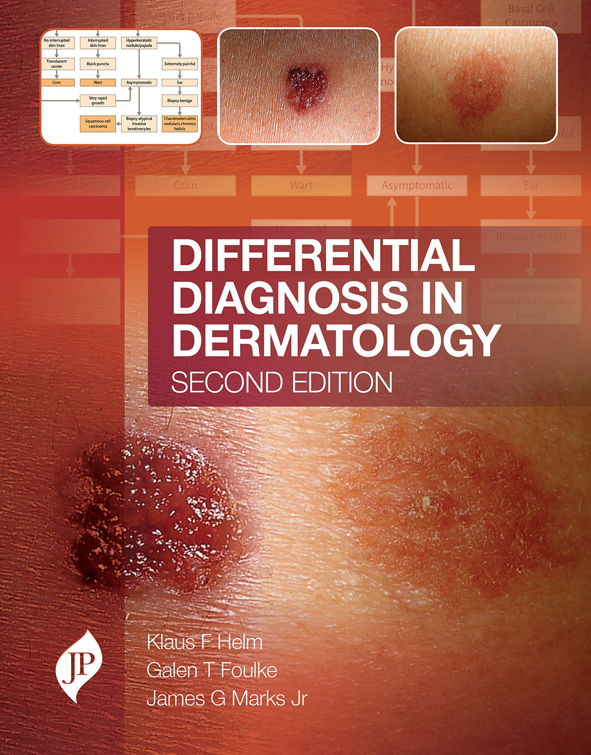 DIFFERENTIAL DIAGNOSIS IN DERMATOLOGY - Retail Maharaj