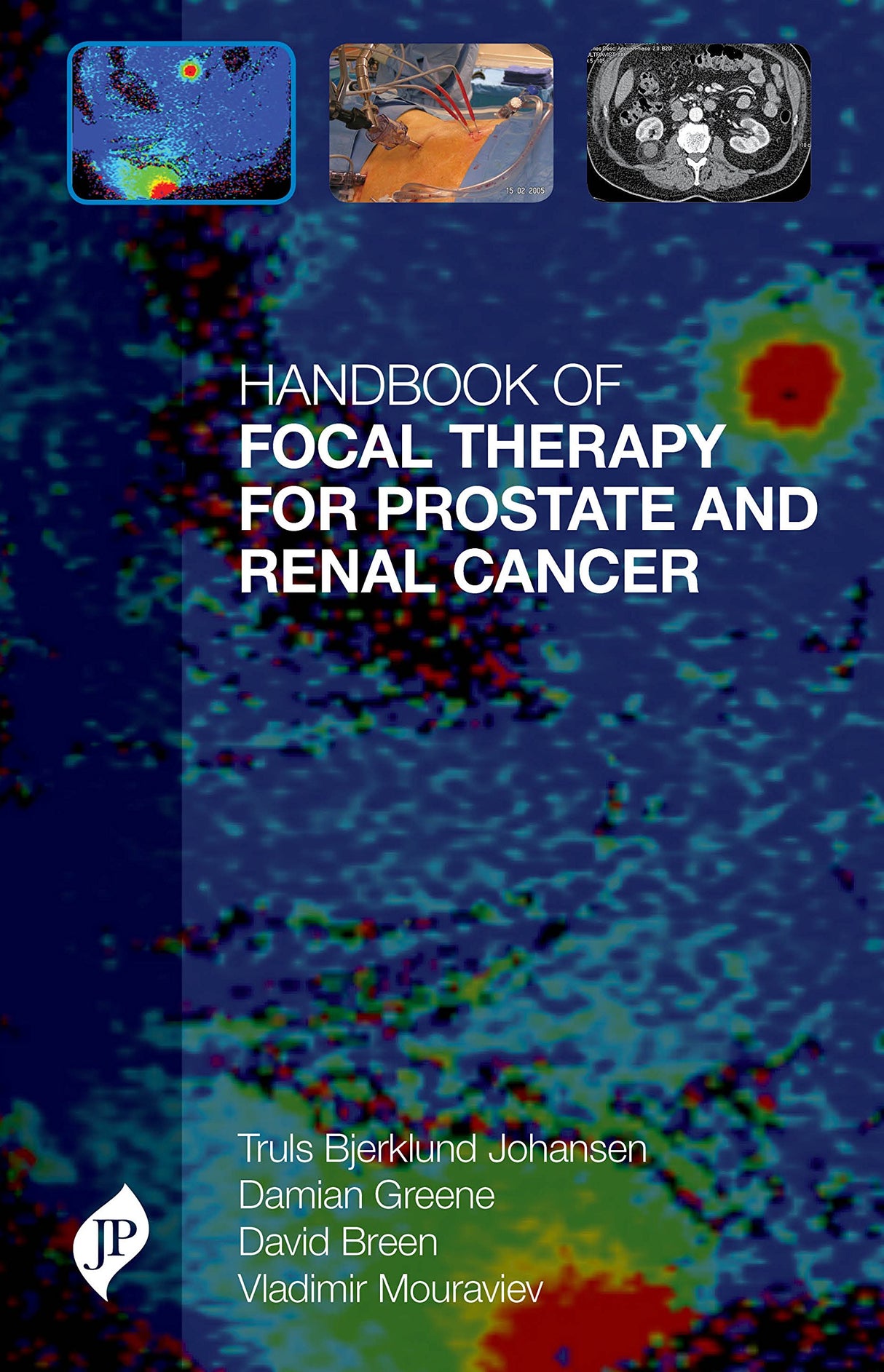Handbook of Focal Therapy for Prostate and Renal Cancer - Retail Maharaj