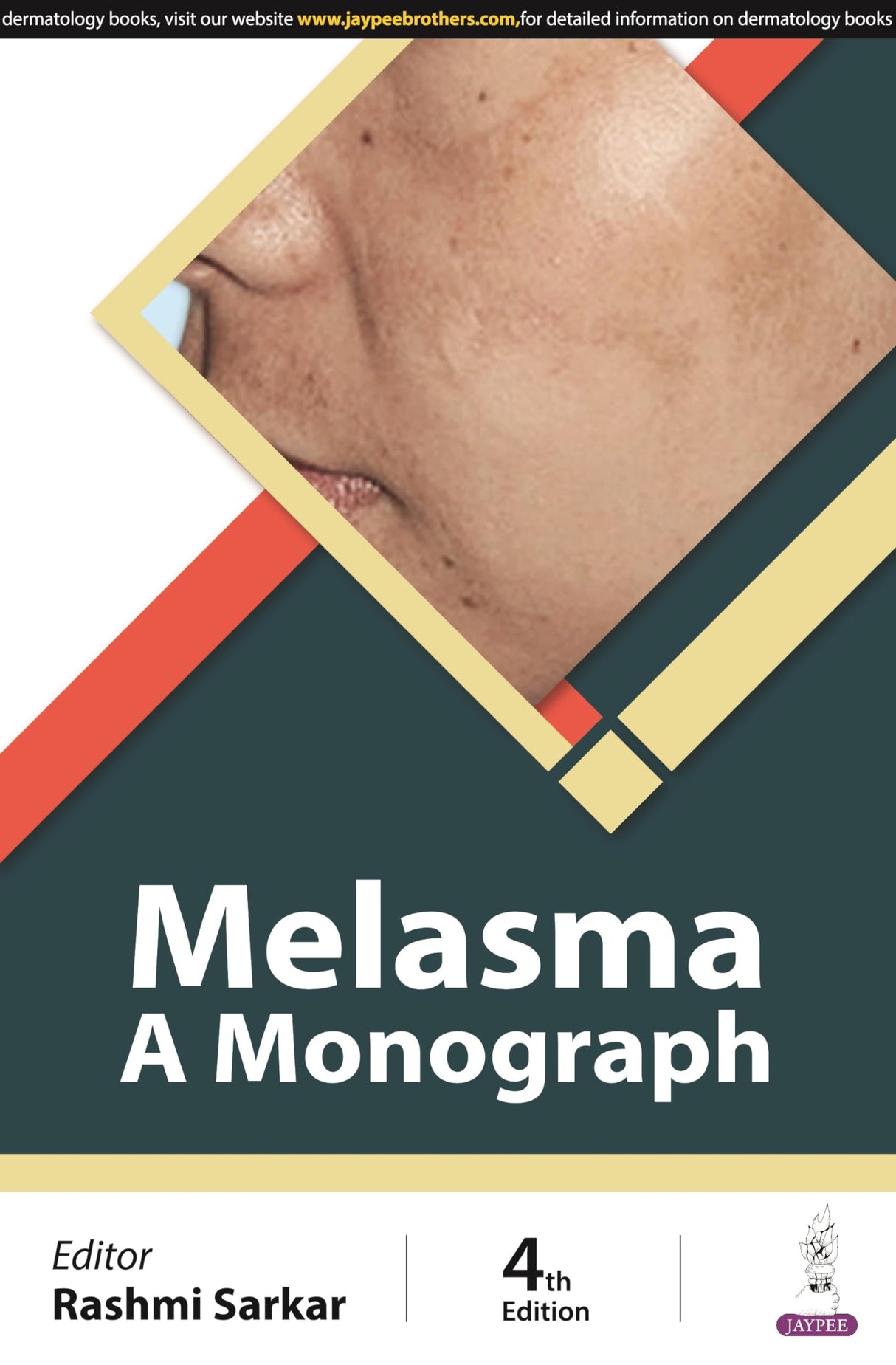 MELASMA: A MONOGRAPH - Retail Maharaj