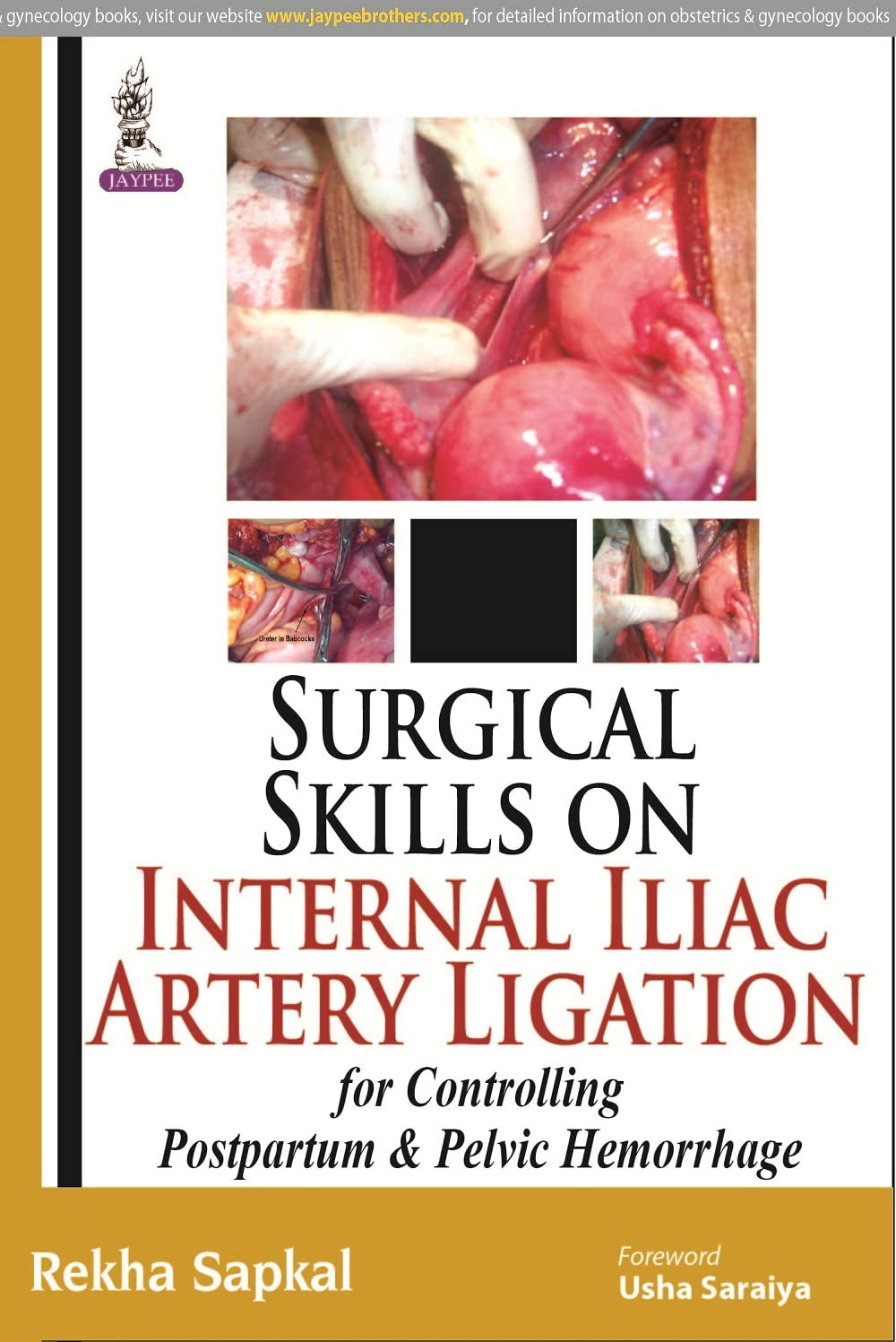 SURGICAL SKILLS ON INTERNAL ILIAC ARTERY LIGATION:FOR CONTROLLING POSTPARTUM & PELVIC HEMORRHAGE - Retail Maharaj