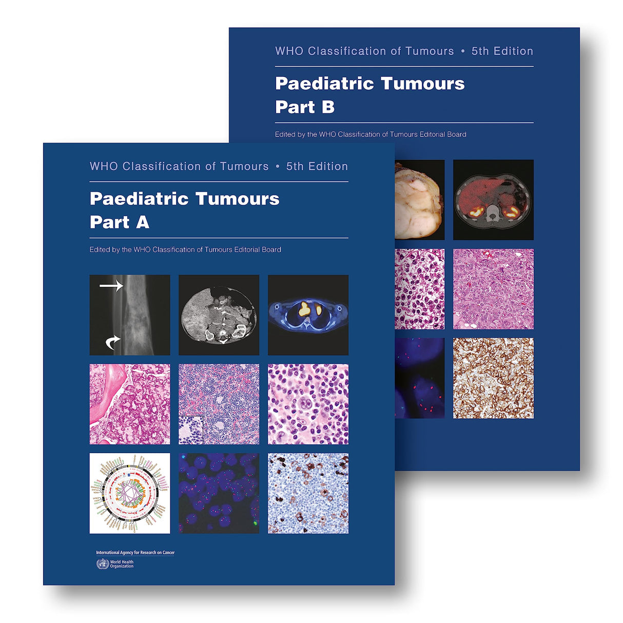 Paediatric Tumours - Retail Maharaj
