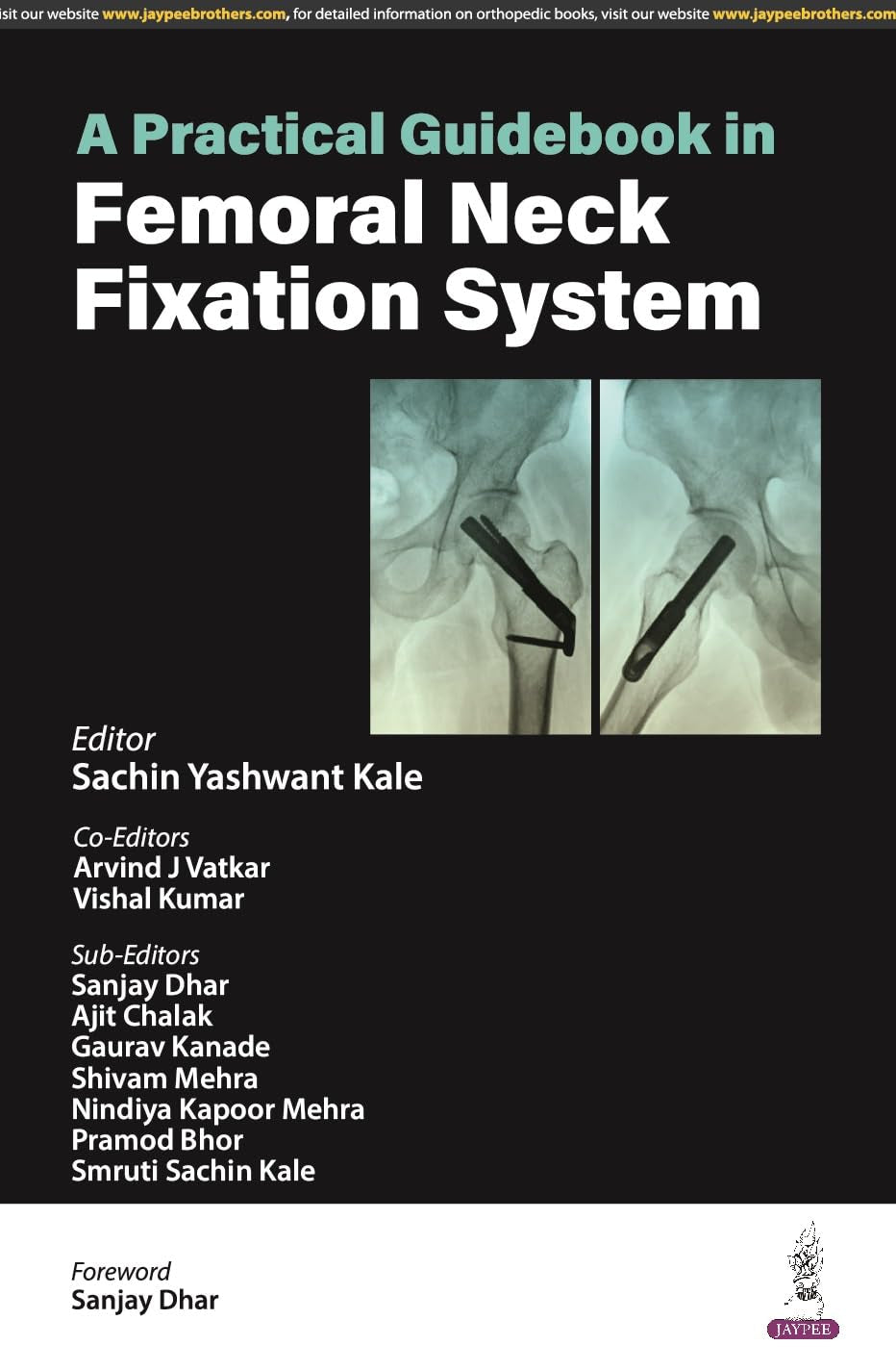 A PRACTICAL GUIDEBOOK IN FEMORAL NECK FIXATION SYSTEM - Retail Maharaj