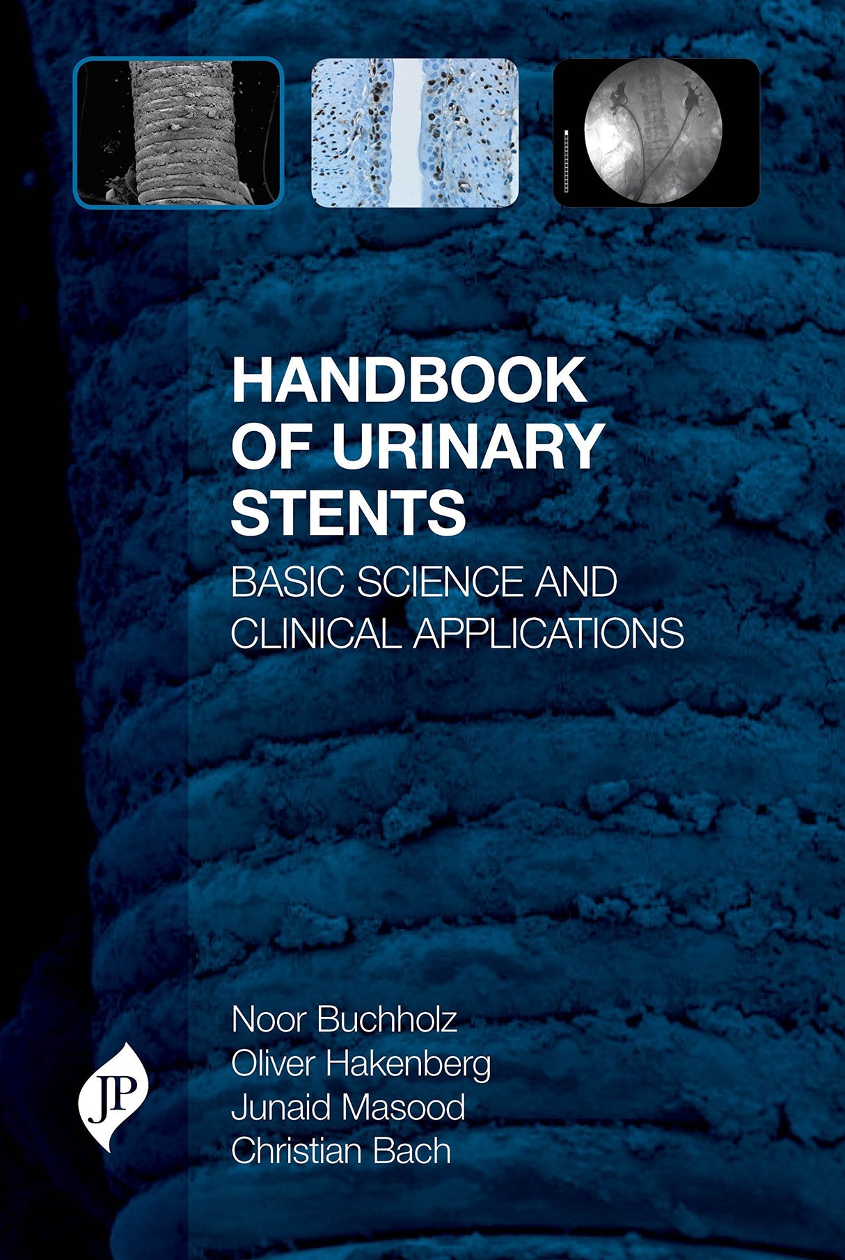 Handbook of Urinary Stents: Basic Science and Clinical Applications - Retail Maharaj