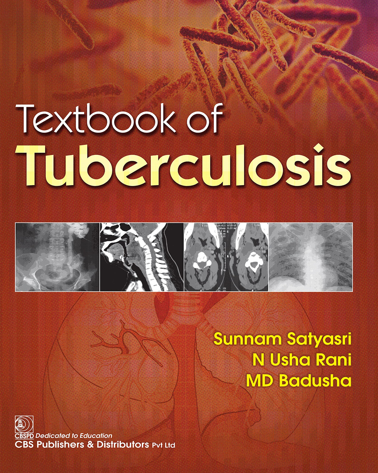 Textbook of Tuberculosis - Retail Maharaj