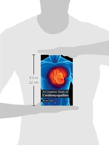Complete Study of Cardiomyopathies - Retail Maharaj