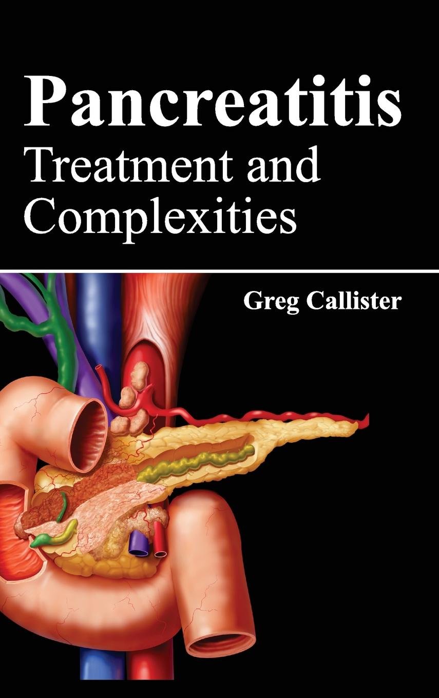 Pancreatitis: Treatment and Complexities - Retail Maharaj