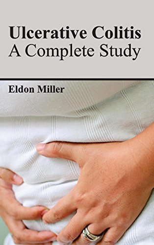 Ulcerative Colitis: A Complete Study - Retail Maharaj