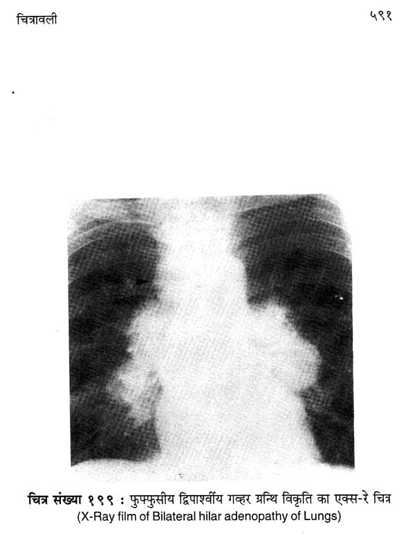 एक्स-रे, सोनोग्राफी, सी.टी. स्कैन एवं एम.आर.आई. डायगनोसिस - X-Ray, Sonography, C.T. Scan & M.R.I. Diagnosis (with Radiographs) - Retail Maharaj