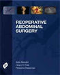 Reoperative Abdominal Surgery - Retail Maharaj