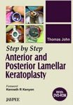STEP BY STEP ANTERIOR AND POSTERIOR LAMELLAR KERATOPLASTY(WITH DVD) - Retail Maharaj