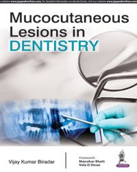 MUCOCUTANEOUS LESIONS IN DENTISTRY - Retail Maharaj