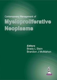 CONTEMPORARY MANAGEMENT OF MYELOPROLIFERATIVE NEOPLASMS - Retail Maharaj