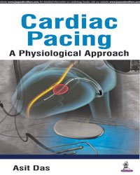 CARDIAC PACING A PHYSIOLOGICAL APPROACH - Retail Maharaj