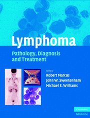Lymphoma: Pathology,Diagnosis and Treatment - Retail Maharaj