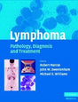 Lymphoma: Pathology,Diagnosis and Treatment - Retail Maharaj