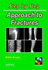 Step by Step Approach to Fractures with Photo CD-ROM - Retail Maharaj