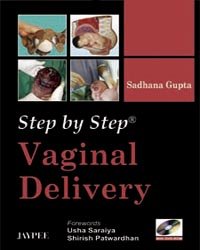 STEP BY STEP VAGINAL DELIVERY WITH DVD-ROM - Retail Maharaj